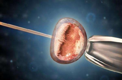 美国试管婴儿科普：试管婴儿冻胚VS鲜胚！如何移植更有利于怀孕？